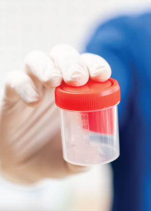 urocultoare